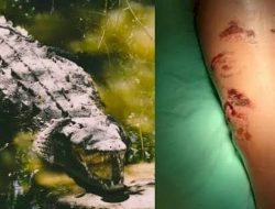 Nyaris Tewas! Pria Kupang Barat Berjuang Lepas dari Gigitan Buaya