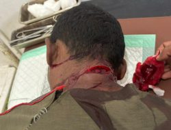 Tragis di TTU, Ayah Ayunkan Parang ke Anak Kandung hingga Luka Serius